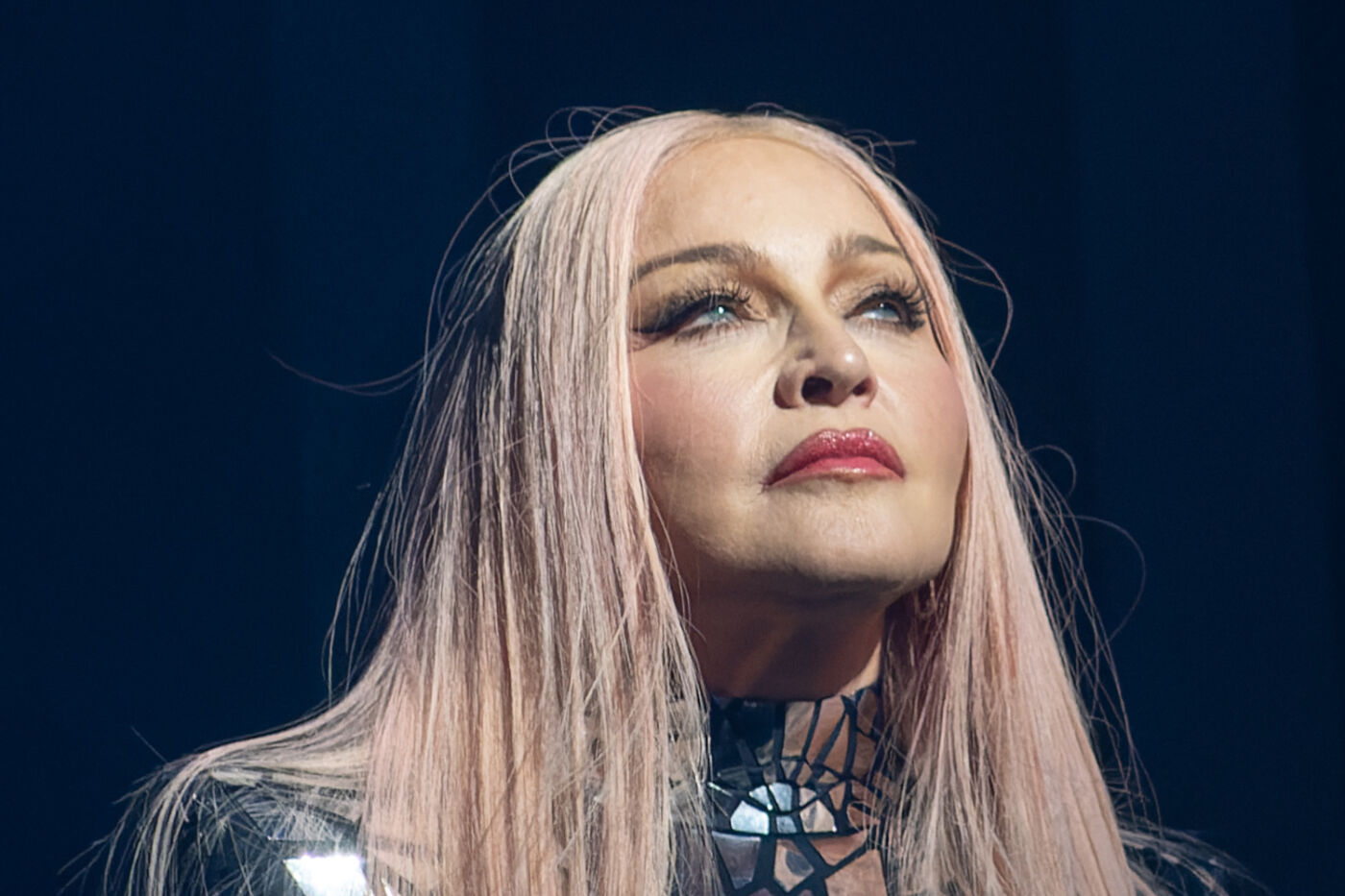 Madonna és az örök ifjúság ára: tényleg túlzásba vitte a popdíva a plasztikát?