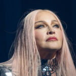 Madonna és az örök ifjúság ára: tényleg túlzásba vitte a popdíva a plasztikát?